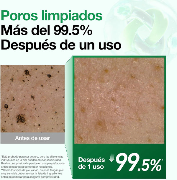 Aspecto de los poros antes y después del uso de la espuma Heartleaf Quercetinol de ANUA