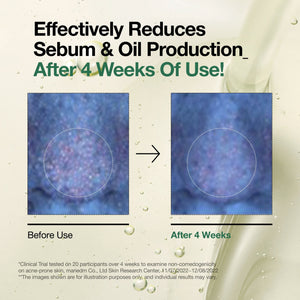 Aspecto de los poros antes y después del uso del limpiador en aceite ANUA Heartleaf Pore Control