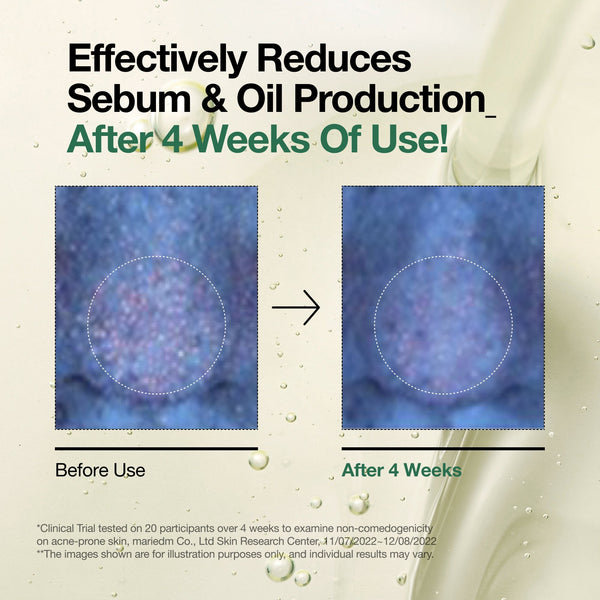 Aspecto de los poros antes y después del uso del limpiador en aceite ANUA Heartleaf Pore Control