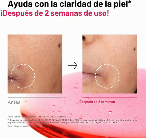 Aspecto de las manchas antes y después del uso del sérum ANUA Niacinamide 10 + TXA 4