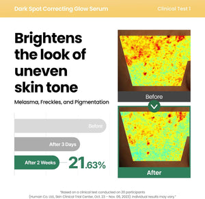 Aspecto del tono de la piel antes y después de usar el sérum AXIS-Y Dark Spot