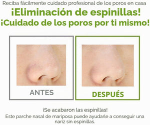 Nariz antes y después de usar el parche Butterfly Nose Strip de G9 Skin