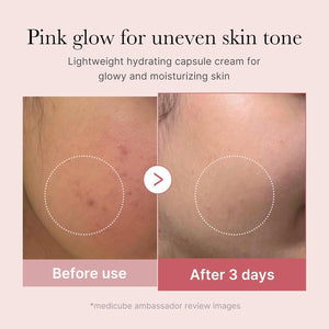Antes y después de tres días con la crema PDRN Pink Collagen de Medicube