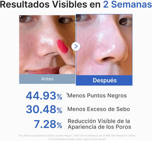 Antes y después de dos semanas usando los discos Zero Pore Pad de Medicube