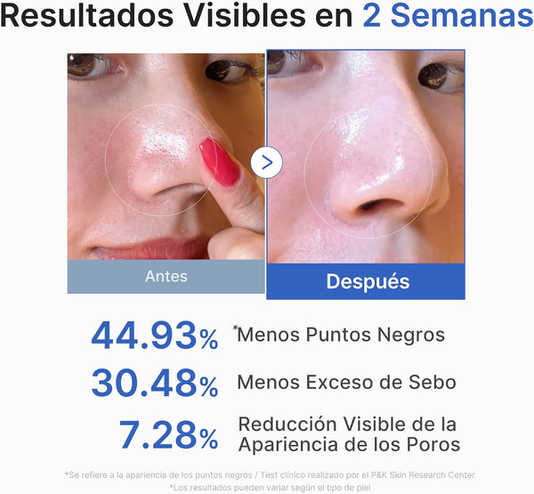 Antes y después de dos semanas usando los discos Zero Pore Pad de Medicube
