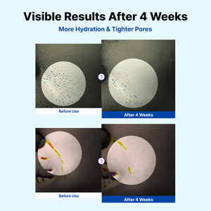 Antes y después de 4 semanas de uso de la Crema Hidratante NIDA