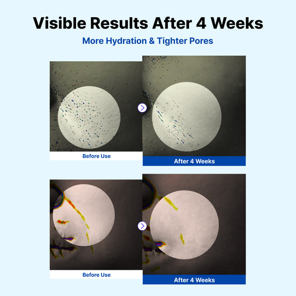Antes y después de 4 semanas de uso de la Crema Hidratante NIDA