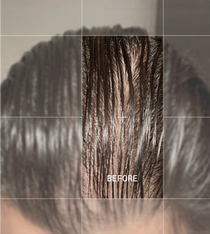 Complemento Capilar Anticaída Next para Mujer (>45) 28u - Olistic